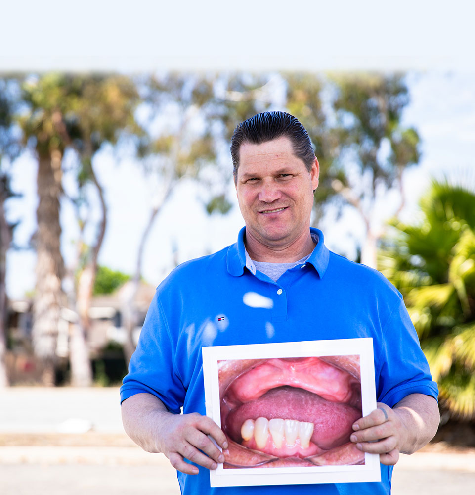 patient happy smiling after service at Dental Implant of san jose